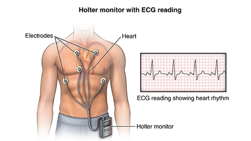 Holter-Monitoring-Services-bg