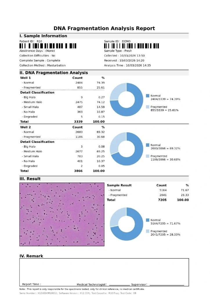 What a Sperm DNA Fragmentation Test Checks